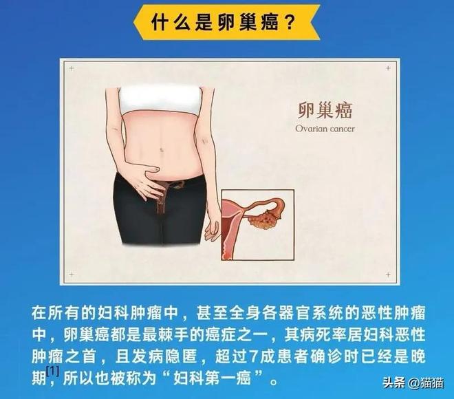 365体育唯一入口：朱媛媛病因曝光是一种被称为妇科肿瘤“死亡率第一杀手”的癌症(图3)