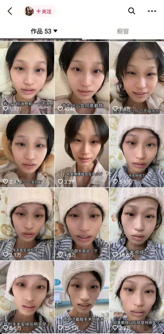 365体育（bet）：太揪心！21岁抗癌女孩饭饭病情再次恶化截肢后癌细胞又肺转移(图2)